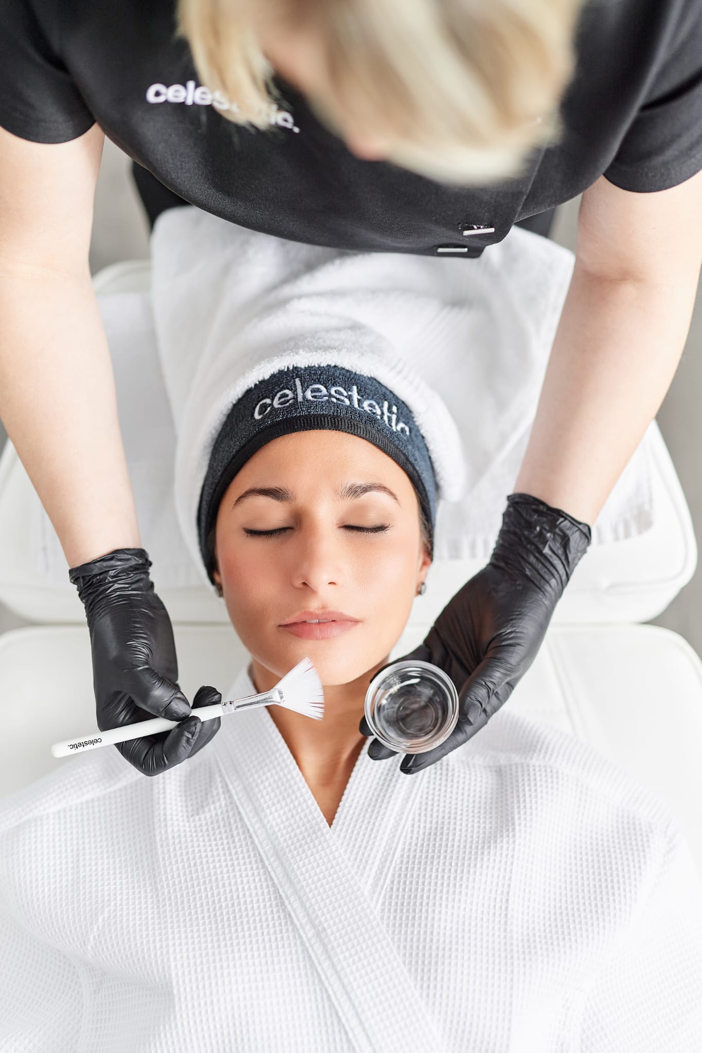 Cure de Peeling Chimique