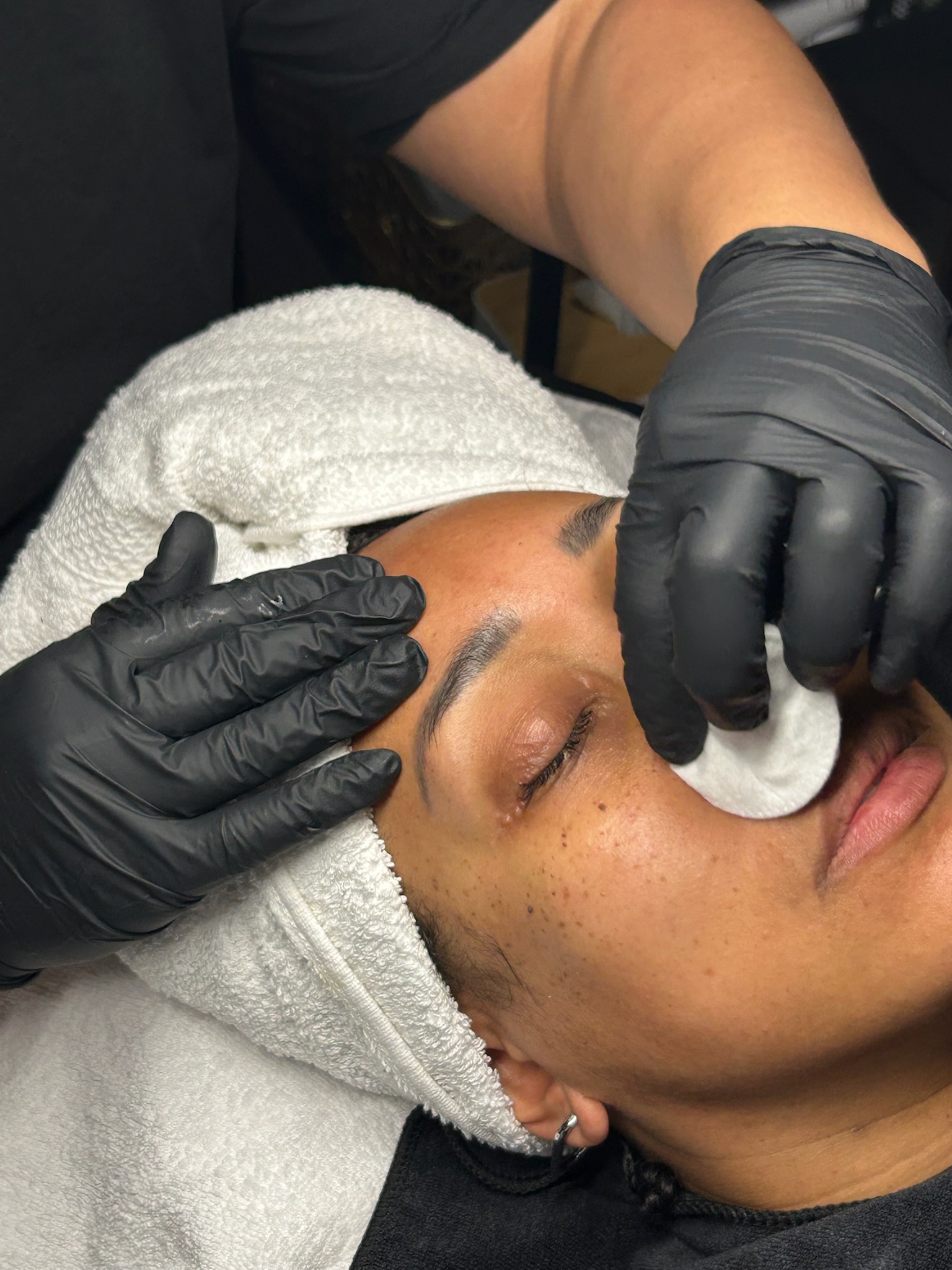 Microneedling — soin du visage réalisé à l'institut Skin by Krys à Pont-Sainte-Maxence (Oise)