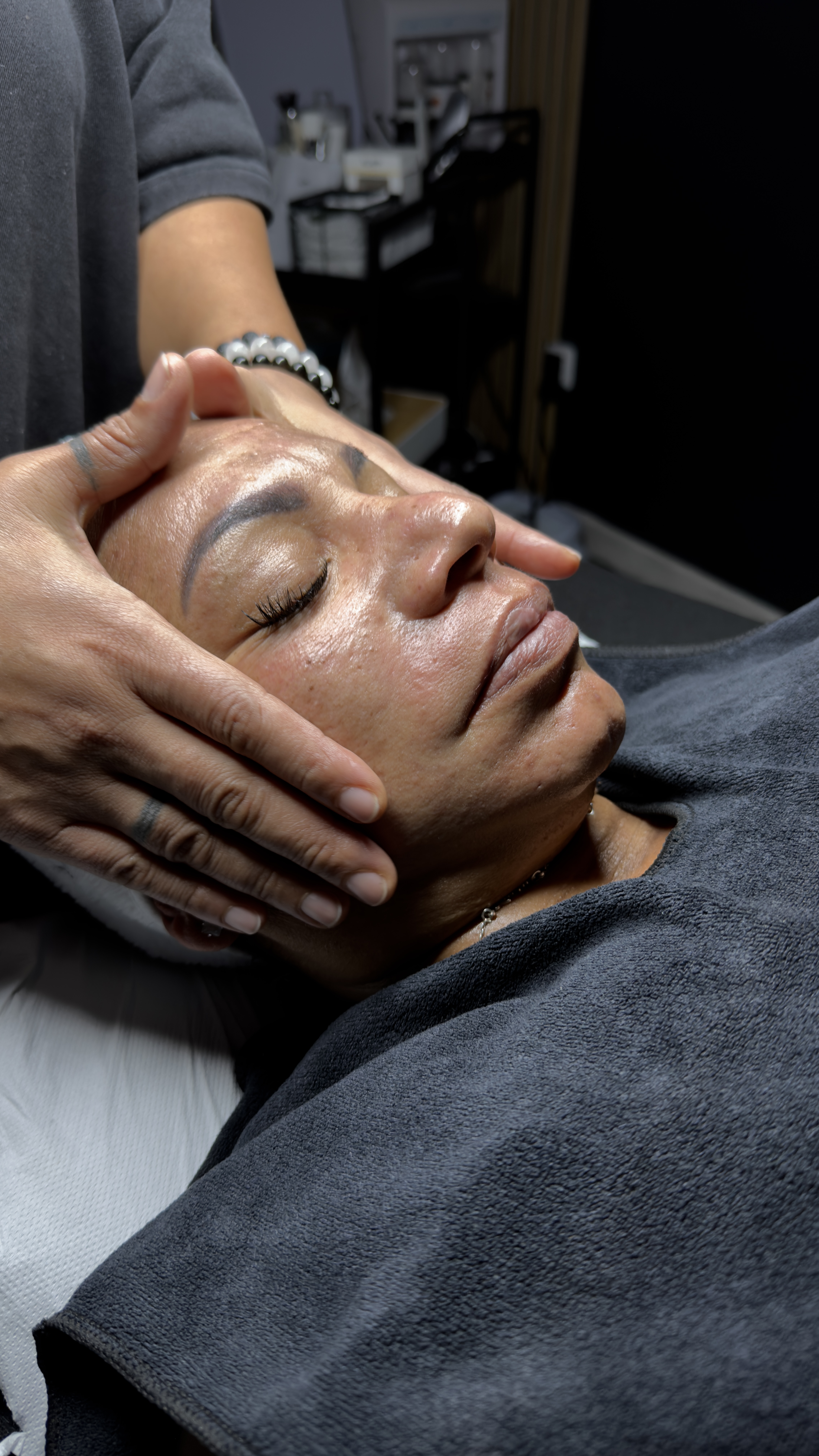 Taches et hyperpigmentation : retrouver un teint lumineux